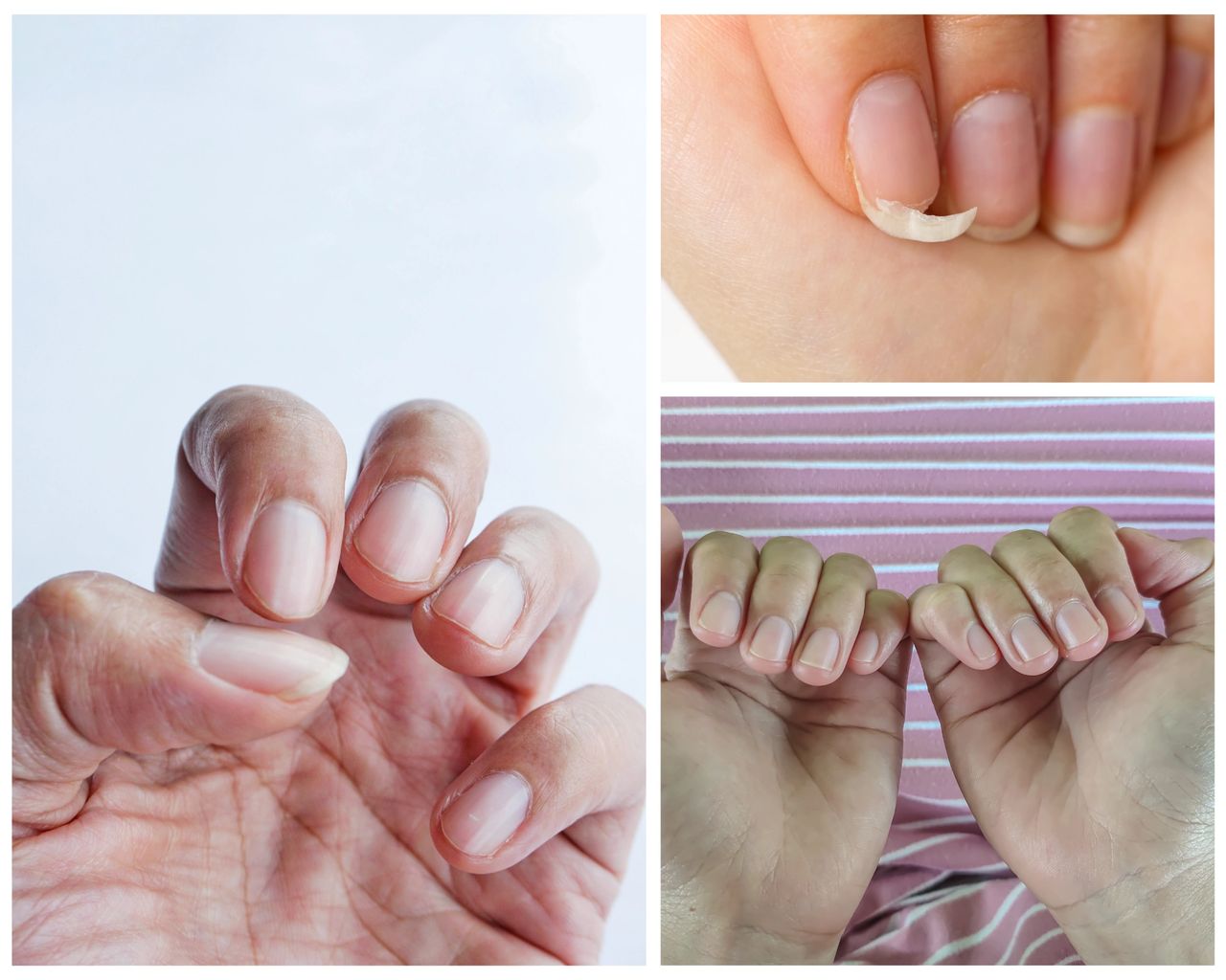 Featured image for article: Comprehensive Guide to Nail Care: A Dermatologist's Perspective