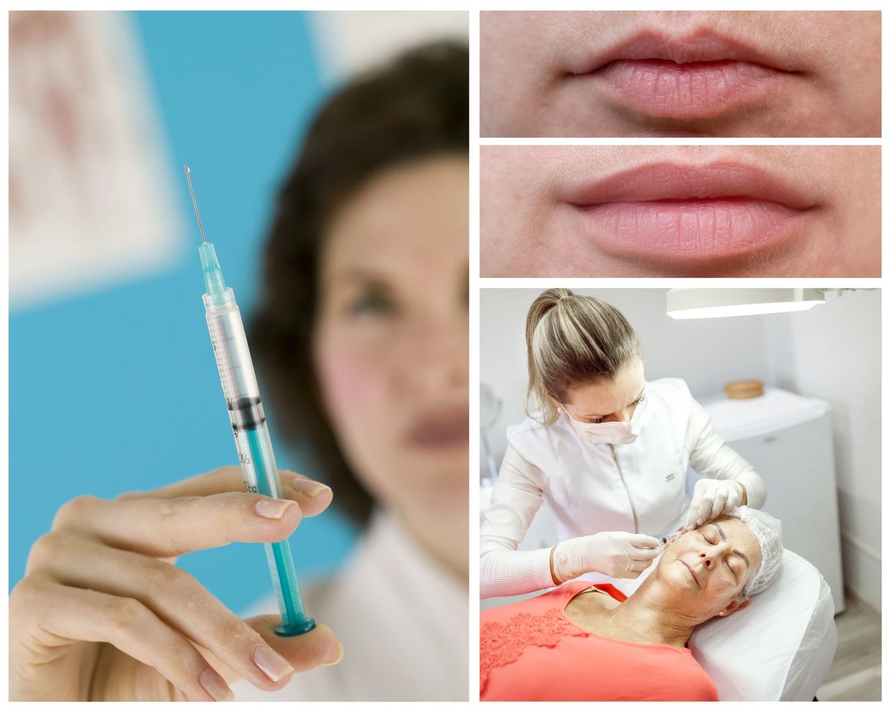 Featured image for article: Dermal Fillers: Restoring Youthful Volume and Smoothness