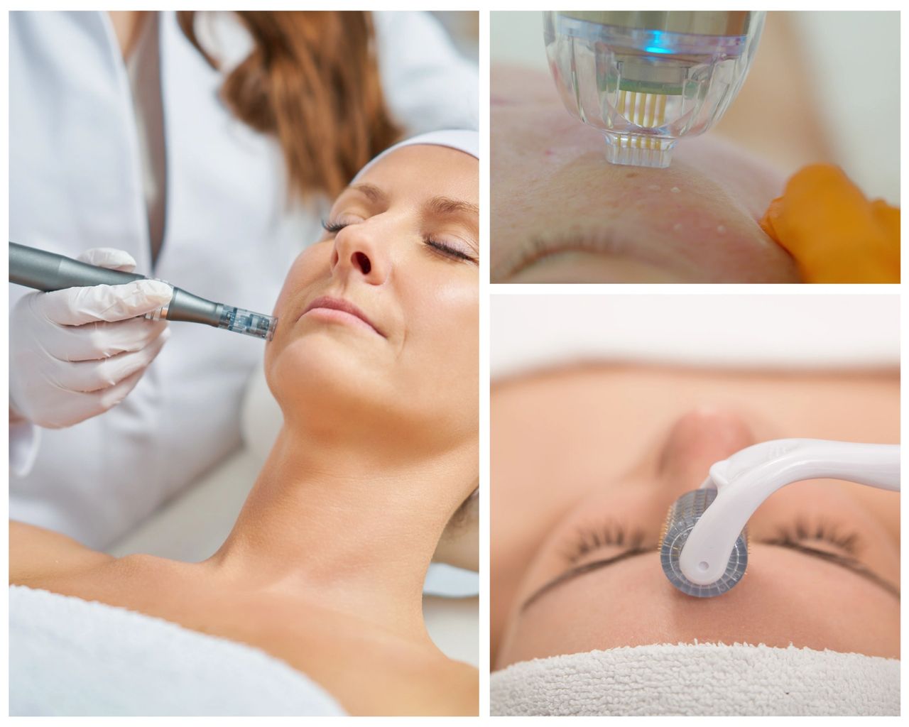 Featured image for article: Microneedling: A Natural Path to Skin Rejuvenation
