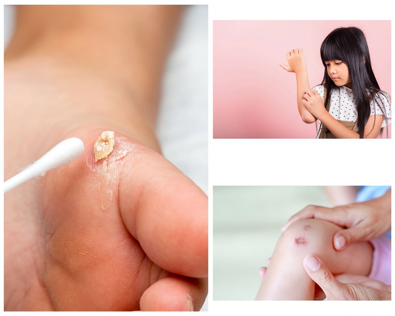 Featured image for article: Pediatric Dermatology: A Comprehensive Guide