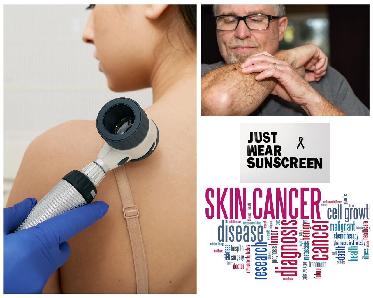 Featured image for article: SKIN CANCER SCREENING: WHY IT'S CRUCIAL AND HOW TO DO IT